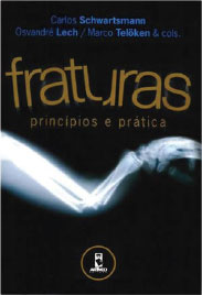 fraturas